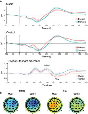 Neural Encoding of Pitch Direction Is Enhanced in Musically Trained Children and Is Related to Reading Skills